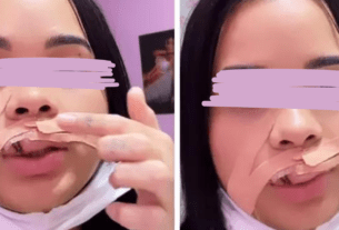 Influencer tem parte do lábio arrancado ao tentar beijar cachorro no Piauí