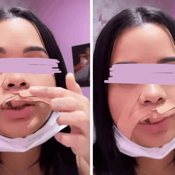 Influencer tem parte do lábio arrancado ao tentar beijar cachorro no Piauí